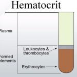 Hematocrit